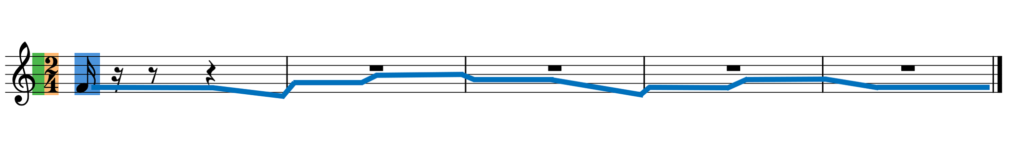 105-Melodic Dictation Pt.4-Dorian Mode | Music Student 101